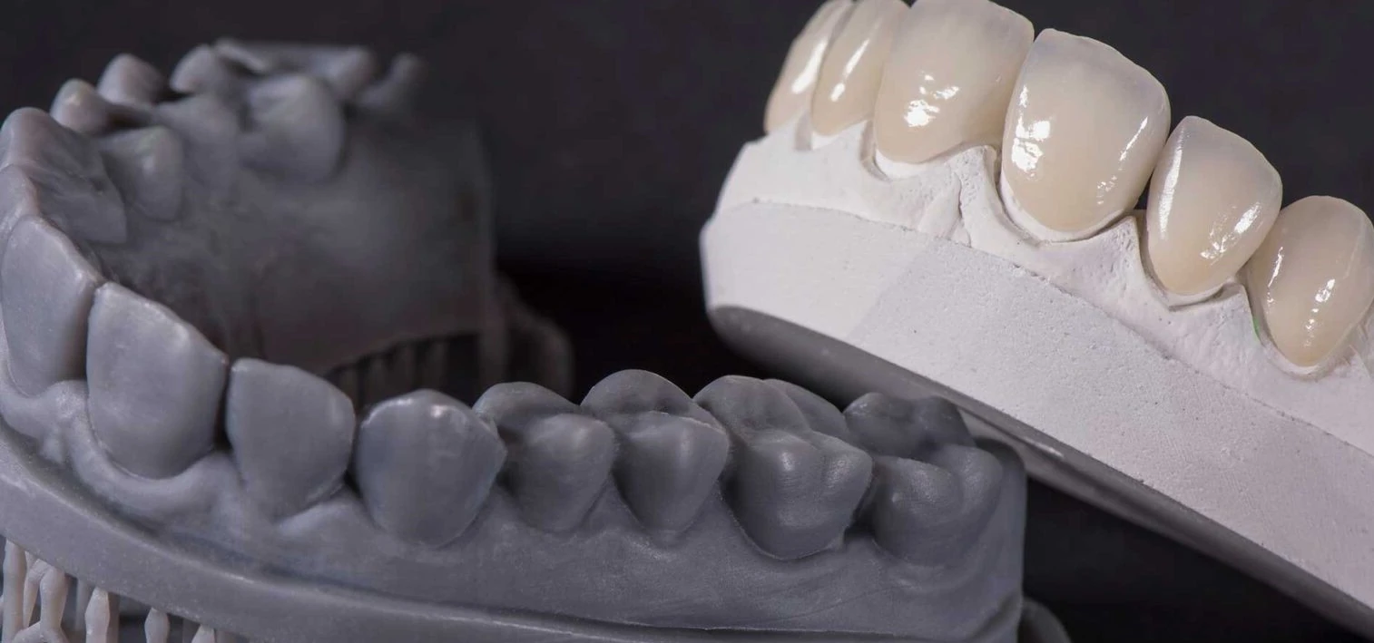 3D-коронки