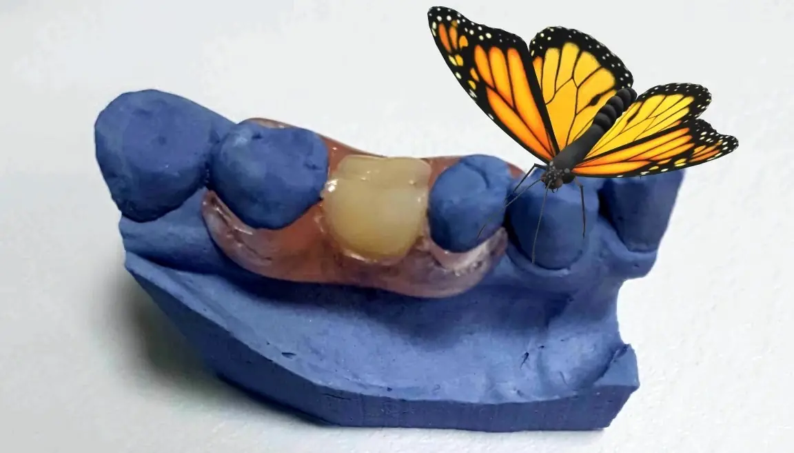 протез метелик протез метелик